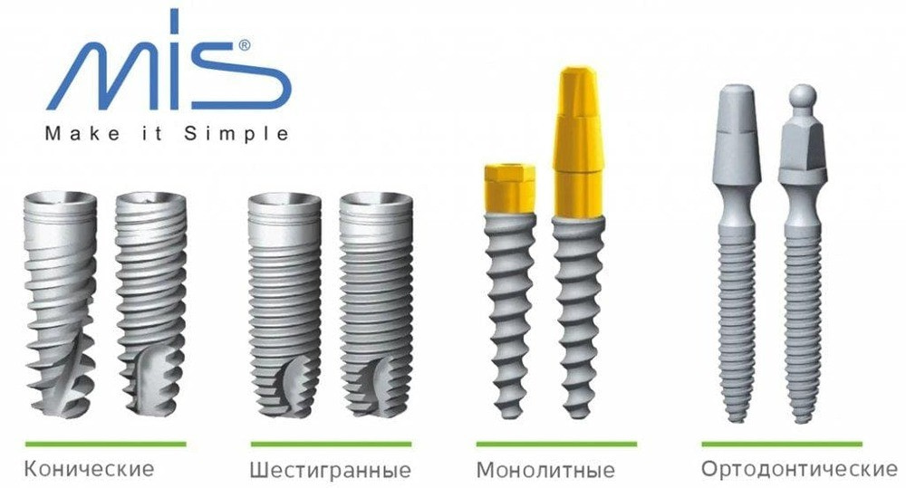 Дентальные импланты MIS